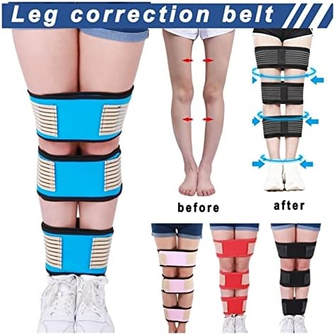 רצועות תיקון רגליים עם 3 חבילות, רצועות תיקון תנוחת רגליים מתכווננות עבור O-Leg, תיקון צורת X-Leg